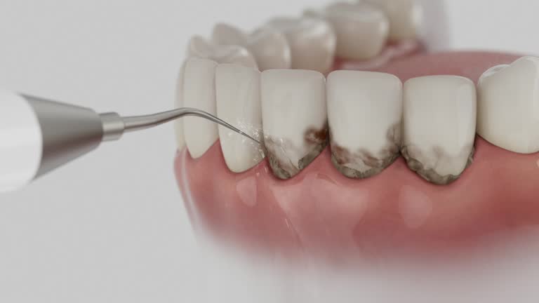 Trusted Tooth Extraction service in Soperton, GA - Dentist Open Now
